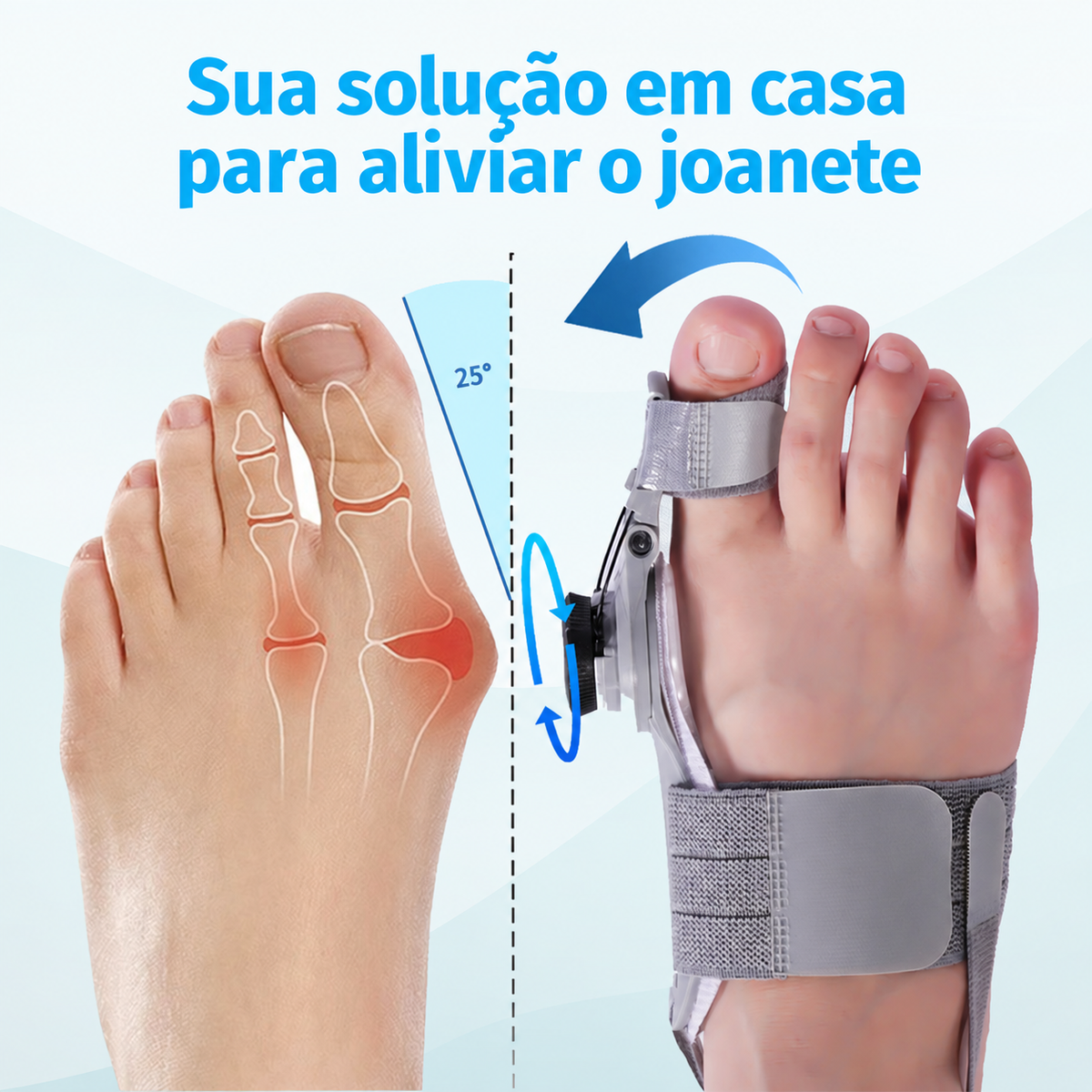 Treatmedy™ Bunion Fix | Corretor de Joanete Ajustável